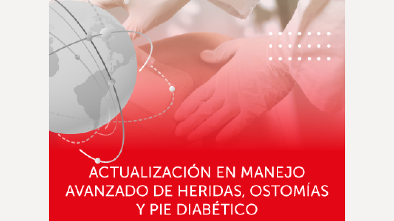 ACTUALIZACIÓN EN MANEJO AVANZADO DE HERIDAS, OSTOMÍAS Y PIE DIABÉTICO. HOSPITAL SAN CARLOS.
